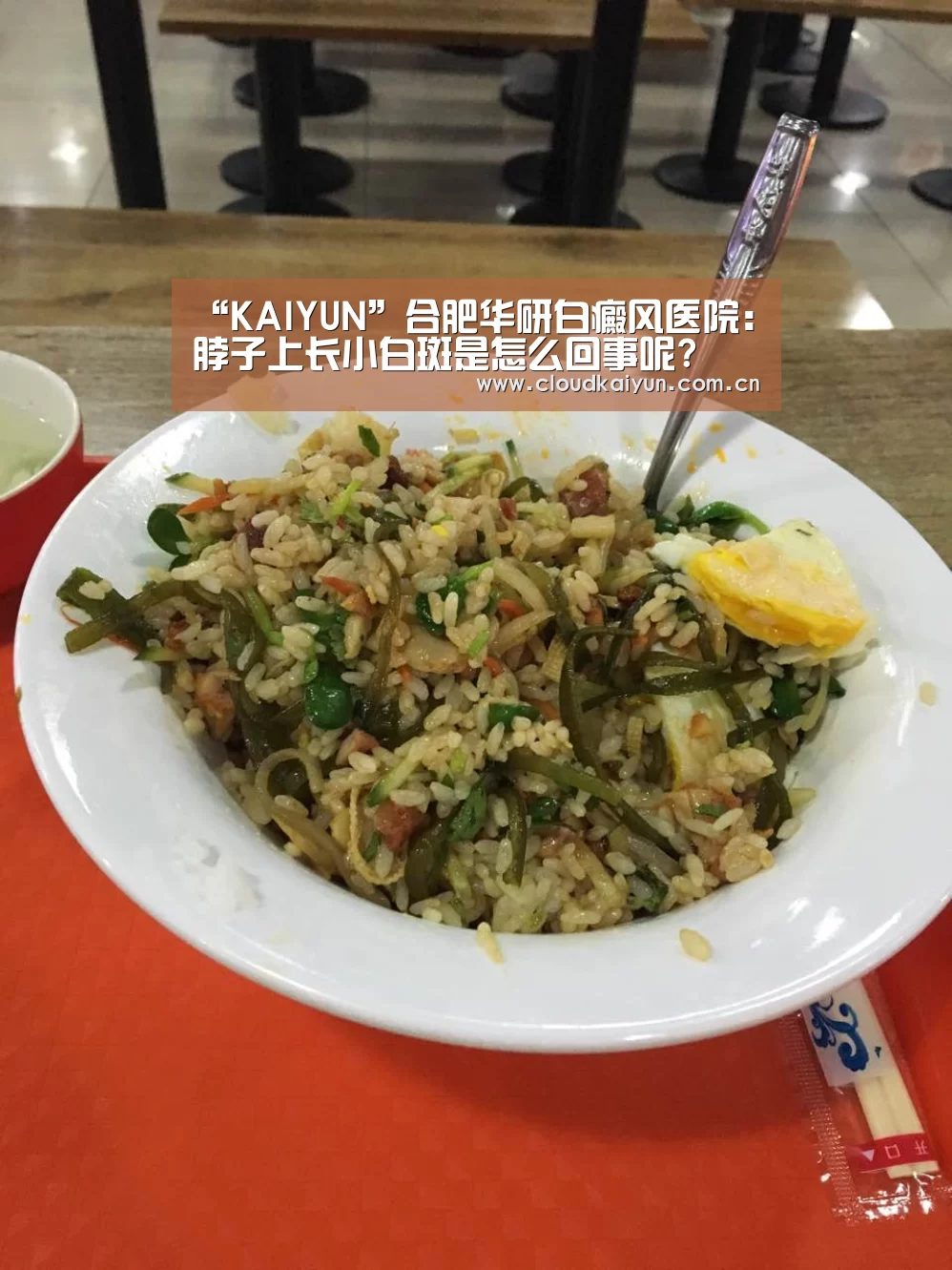 “KAIYUN”合肥华研白癜风医院:脖子上长小白斑是怎么回事呢?(图3) 开云官网